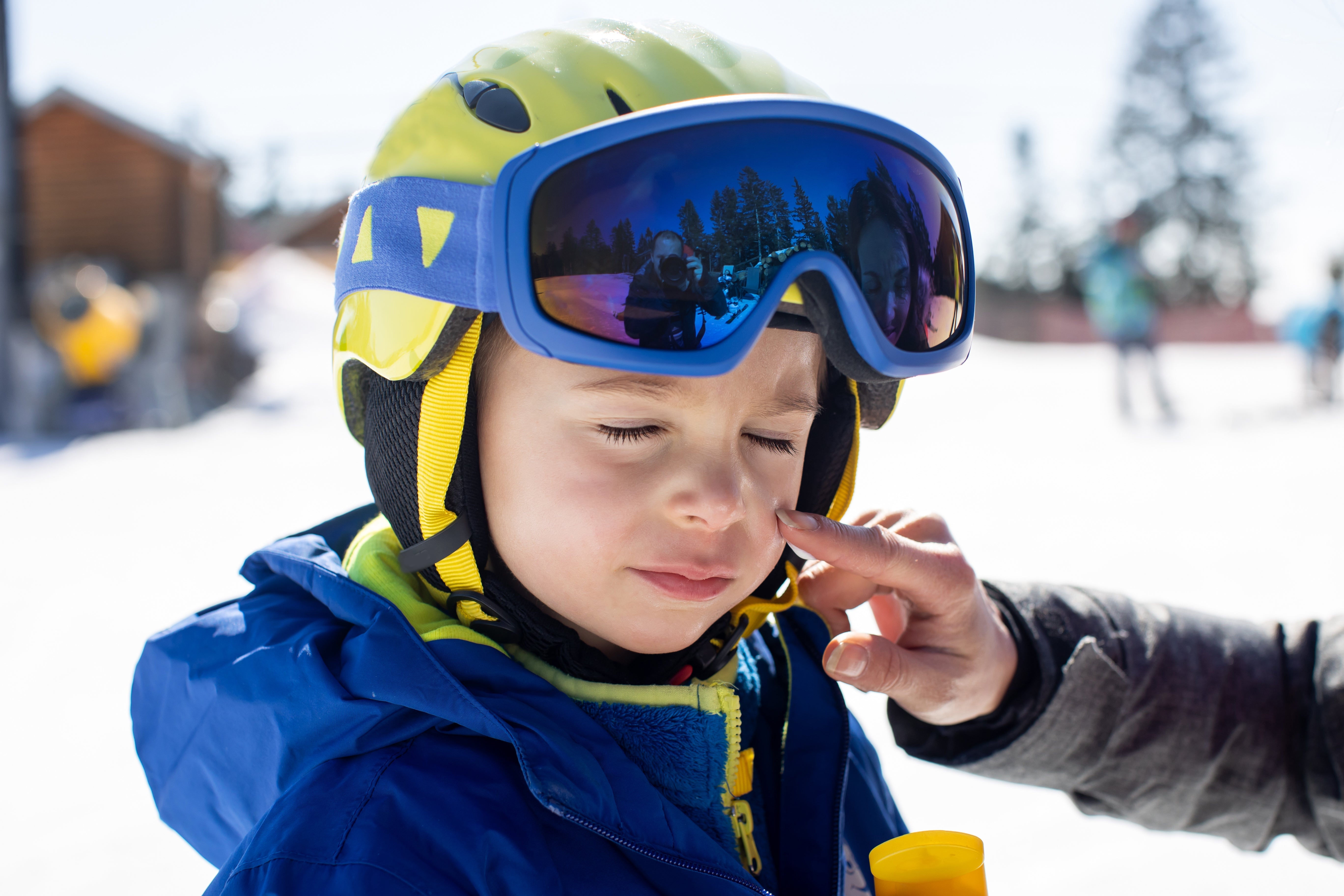 Child wearing a bright yellow ski helmet and blue goggles, having sunscreen applied to their face to protect against UV rays during a sunny winter day on the slopes.